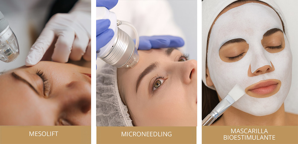 mesolift, microneedling, Mascarilla Bioestimulante 